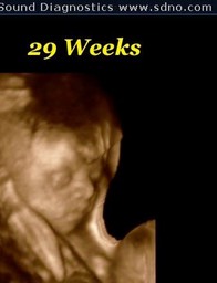 29wk7