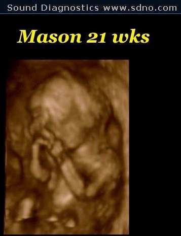 mason21w2