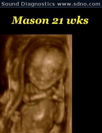 mason21w4