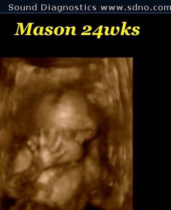 mason24w1