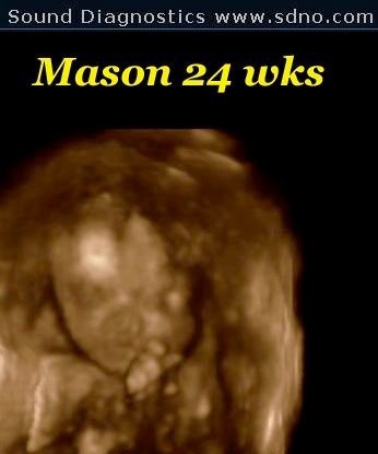 mason24w2