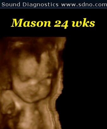 mason24w3