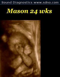 mason24w4