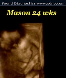 mason24w6