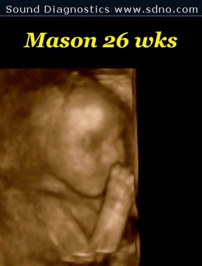 mason26w4