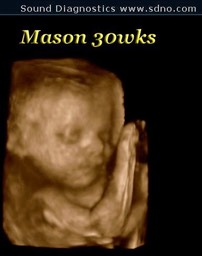 mason30wk6