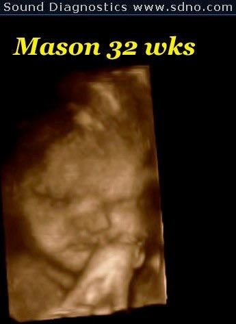 mason32wks2