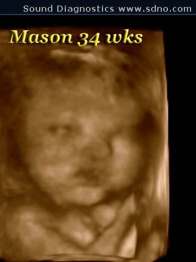 mason34wk1