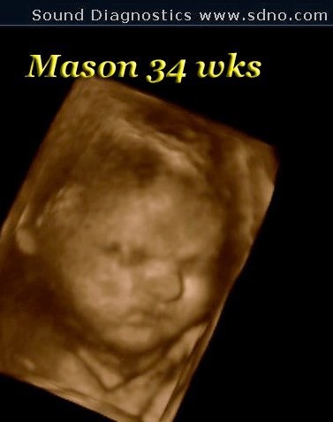 mason34wk3