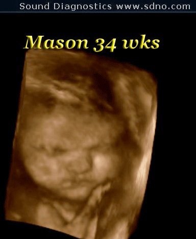 mason34wk4